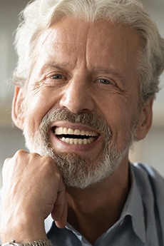 Man smiling with dentures in Orange