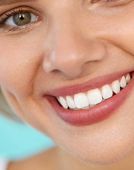 woman smiling after getting a smile makeover