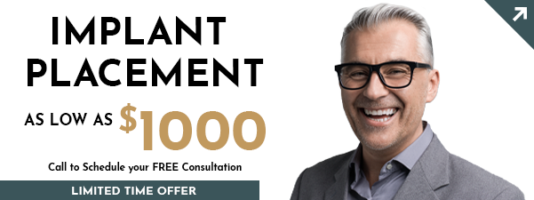 Dental implant tooth replacement special coupon