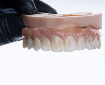 A model of fixed implant dentures.