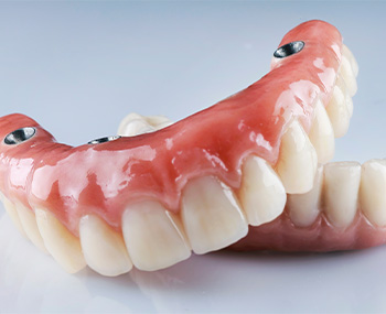 A model of removable implant dentures.