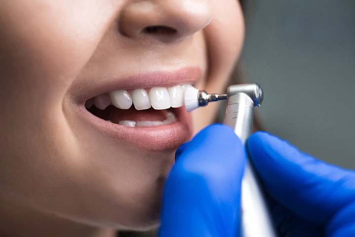 A woman getting a dental cleaning near Old Towne