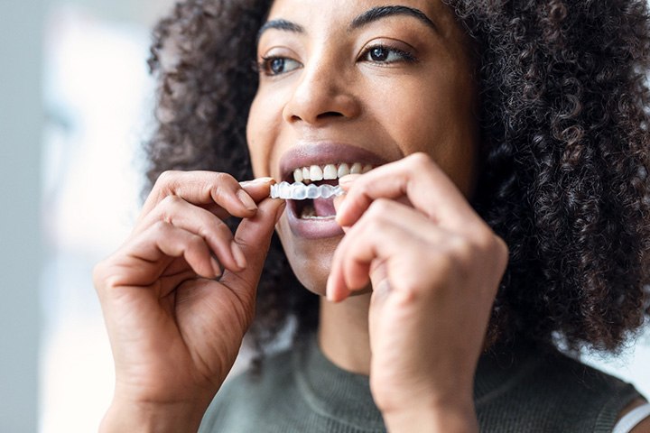 A woman putting on a clear aligner near Old Towne